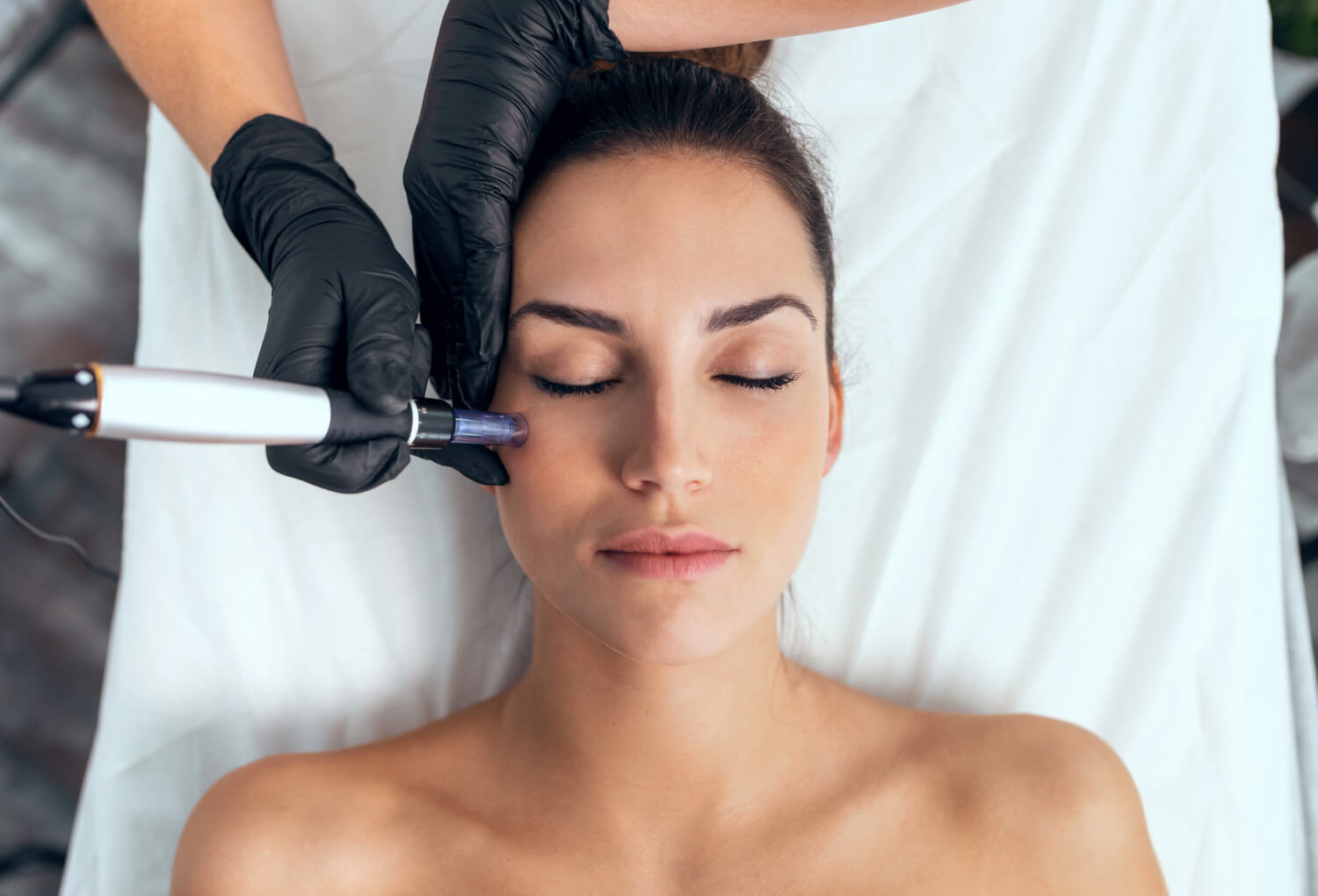 Laser Facial Treatment